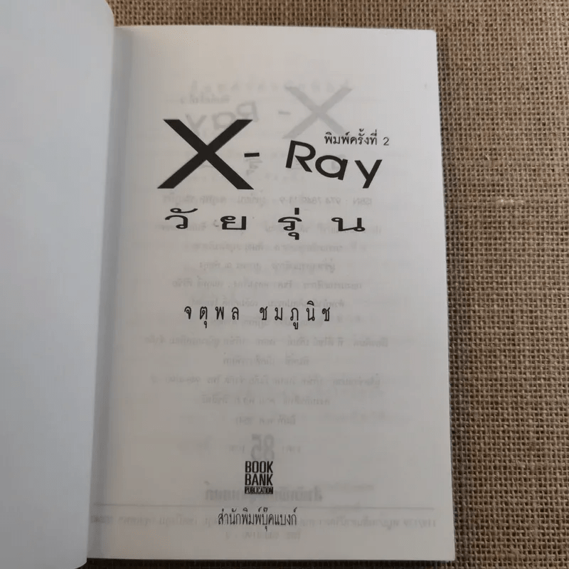 X Ray วัยรุ่น - จตุพล ชมภูนิช