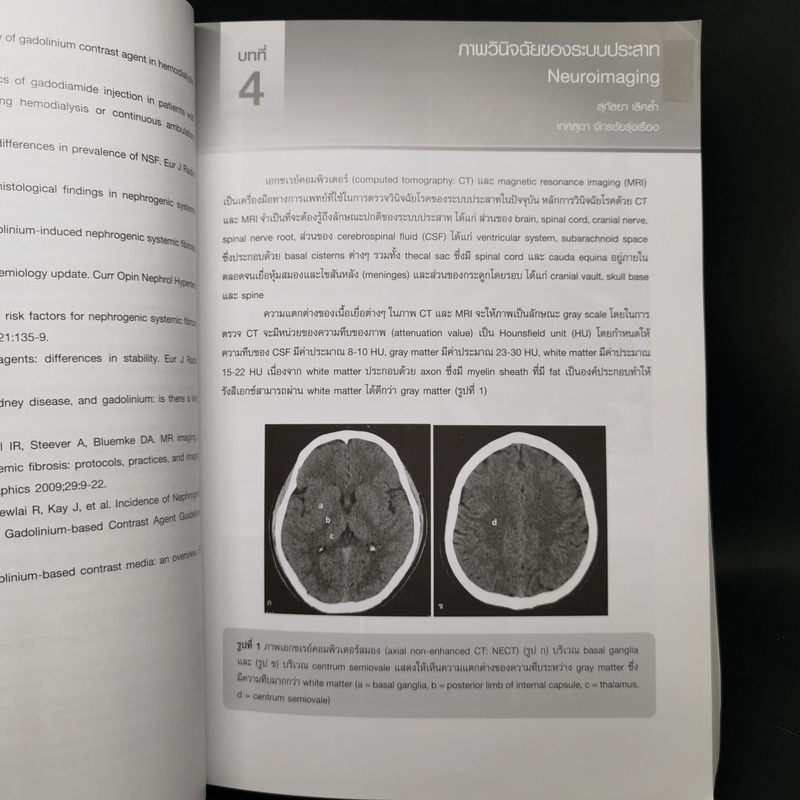 หลักรังสีวิทยาวินิจฉัย Principle of Diagnostic Radiology