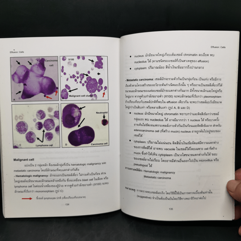 Atlas of Hematology and Body Fluides ภาควิชาพยาธิวิทยาคลินิก