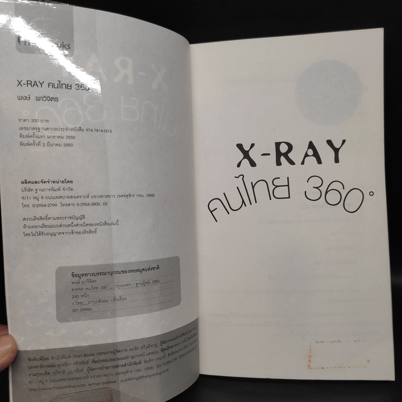 X-Ray คนไทย 360 ํ - พงษ์ ผาวิจิตร