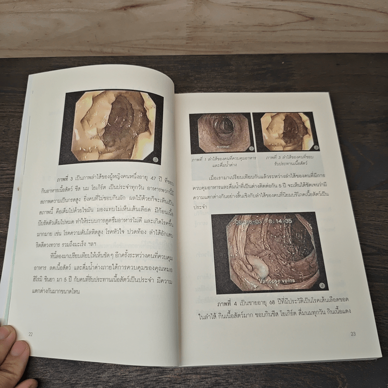 กิน-ดื่มด่างล้างพิษตับ - ปานเทพ พัวพงษ์พันธ์