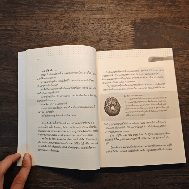 Lifescan มากกว่าที่ตาเห็น - ผมอยู่ข้างหลังคุณ