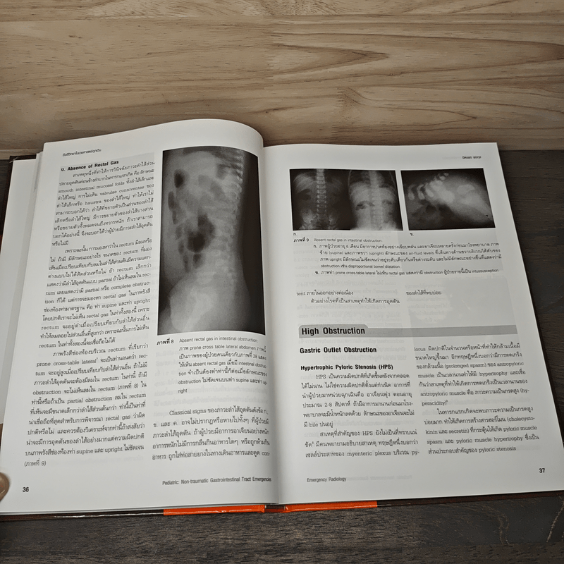 Emergency Radiology รังสีวิทยาในเวชศาสตร์ฉุกเฉิน