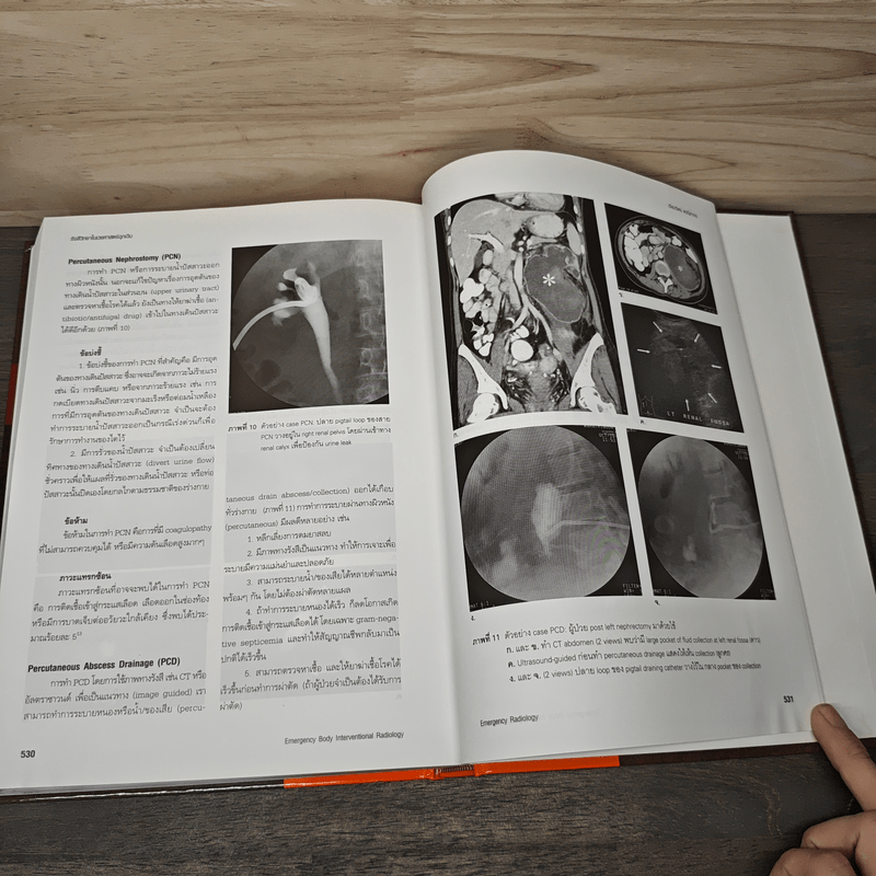 Emergency Radiology รังสีวิทยาในเวชศาสตร์ฉุกเฉิน