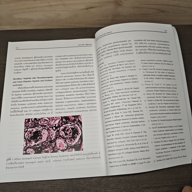 Essentials of Glomerular Disease - บัญชา สถิระพจน์